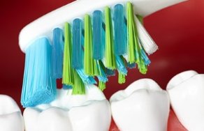 Как правильно выбрать зубную щетку? Разновидности зубных щеток