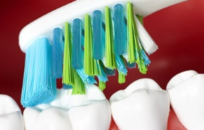 Как правильно выбрать зубную щетку? Разновидности зубных щеток